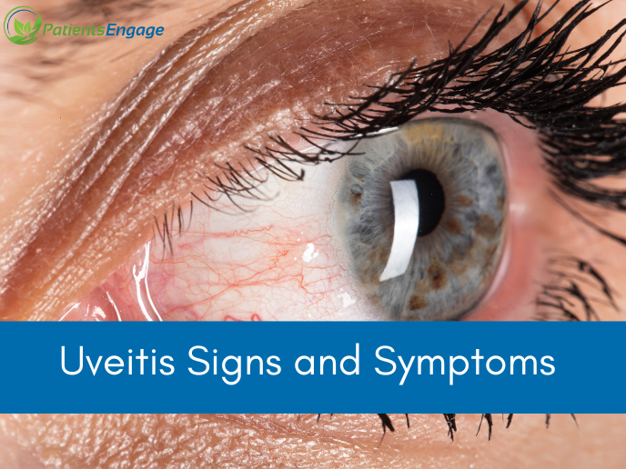 Signs And Symptoms Of Uveitis | PatientsEngage